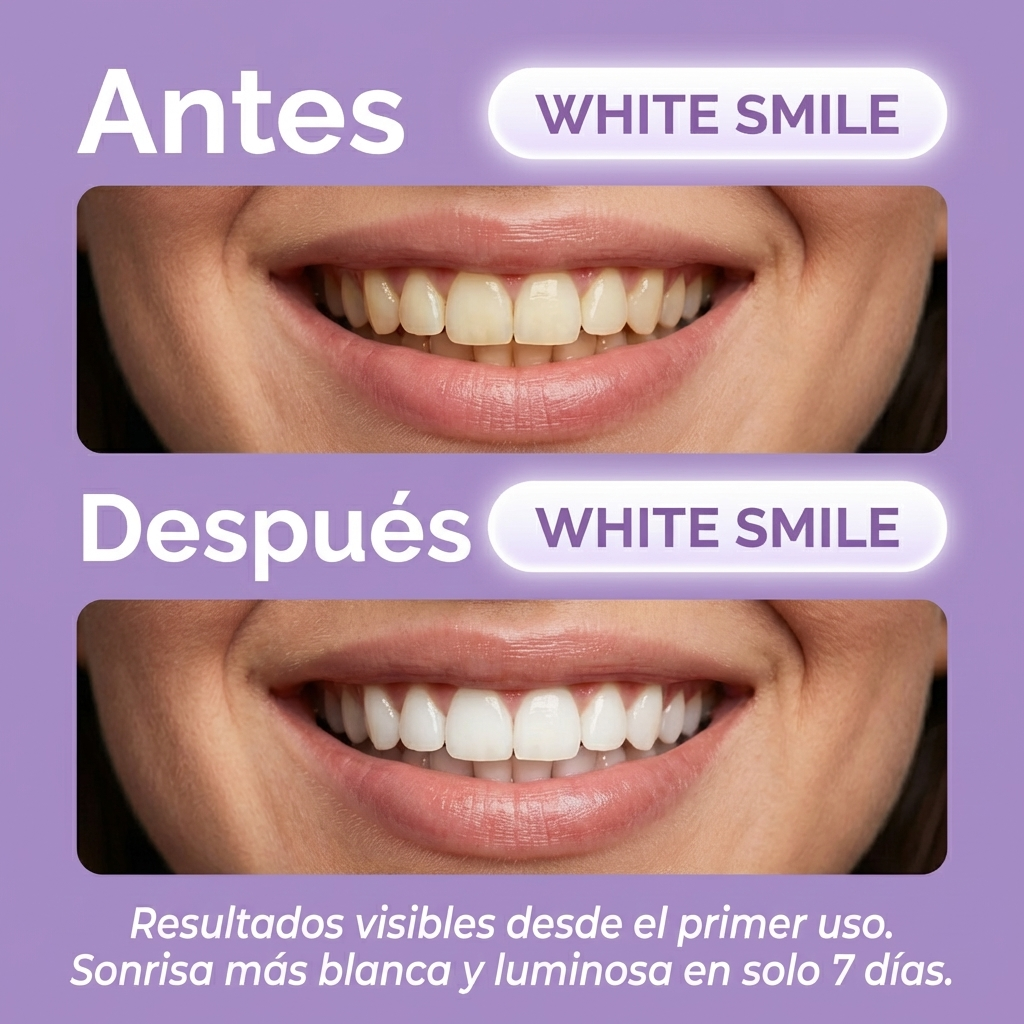 White Smile Tiras Blanqueadoras